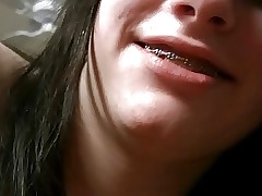 Young Teen here Braces
